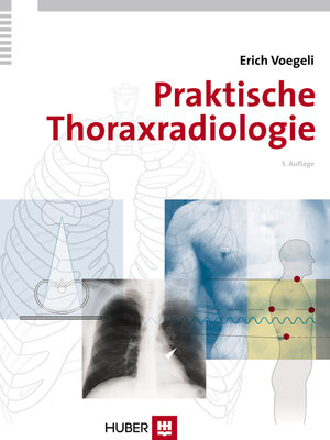 cover image of Praktische Thoraxradiologie